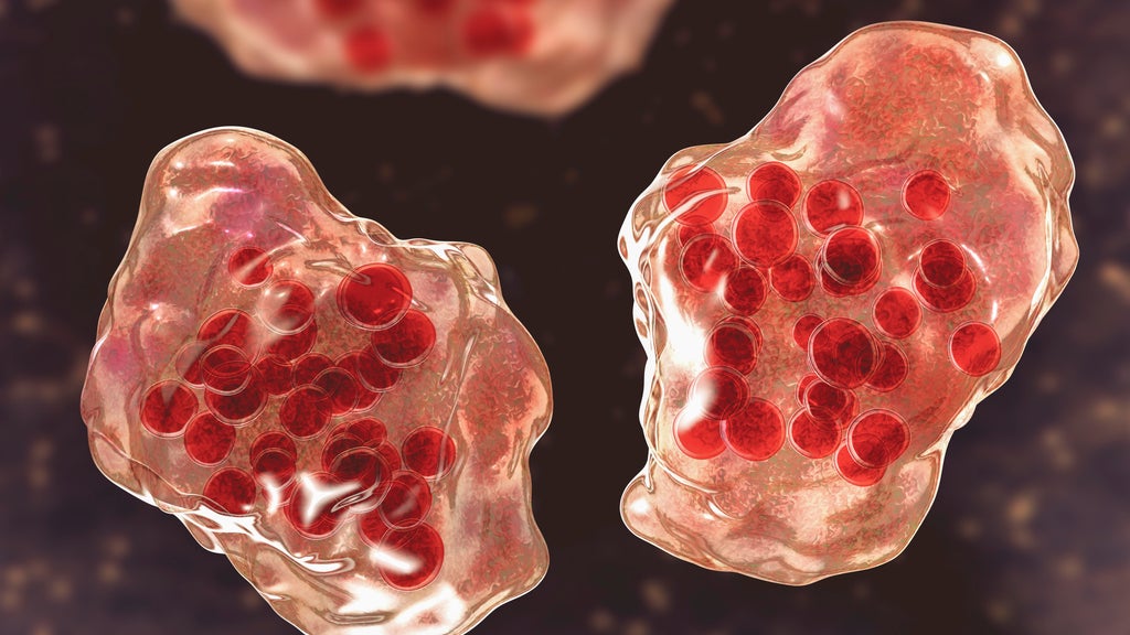 Central Minnesota county reports "several cases of suspected measles" — WCCO / CBS Minnesota, Shakopee Health news