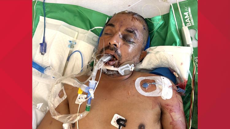 University Hospital asks for help identifying unconscious patient hit by truck Saturday evening — KENS 5 (San Antonio), Shakopee Health news
